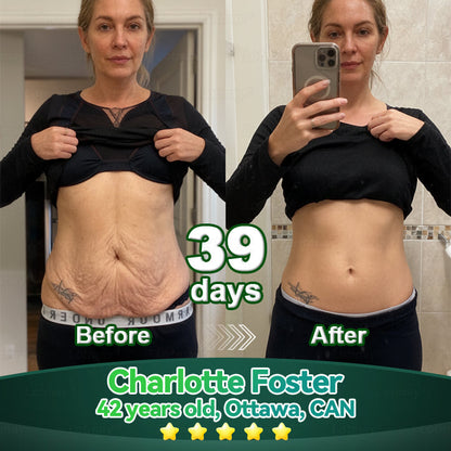 Lotmay® Stem Cell Collagen Peptide Oral Drops🎁🎁