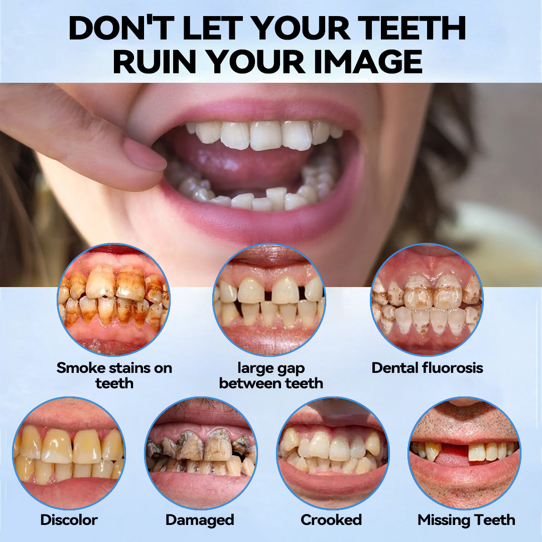 𝐁𝐢𝐤𝐞𝐧𝐝𝐚™🌌 Silicone Reline Denture Set (⏰ Limited Time Discount Last 30 Minutes ⏰)